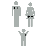 Illustration of Rh factor: baby is ++Rh positive