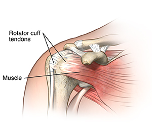 Front view of shoulder joint showing ligaments, muscles and tendons.